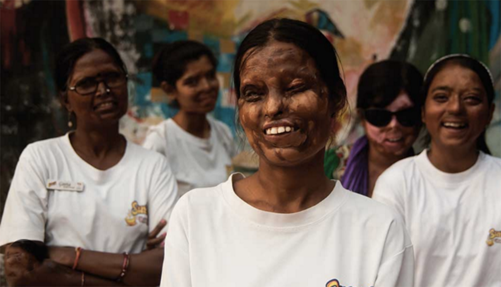 ACID ATTACKS IN INDIA
